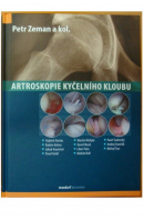 Artroskopie kyčelního kloubu - ZEMAN Petr a kol.